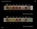 Neisseria gonorrhoeae biochemical identification
